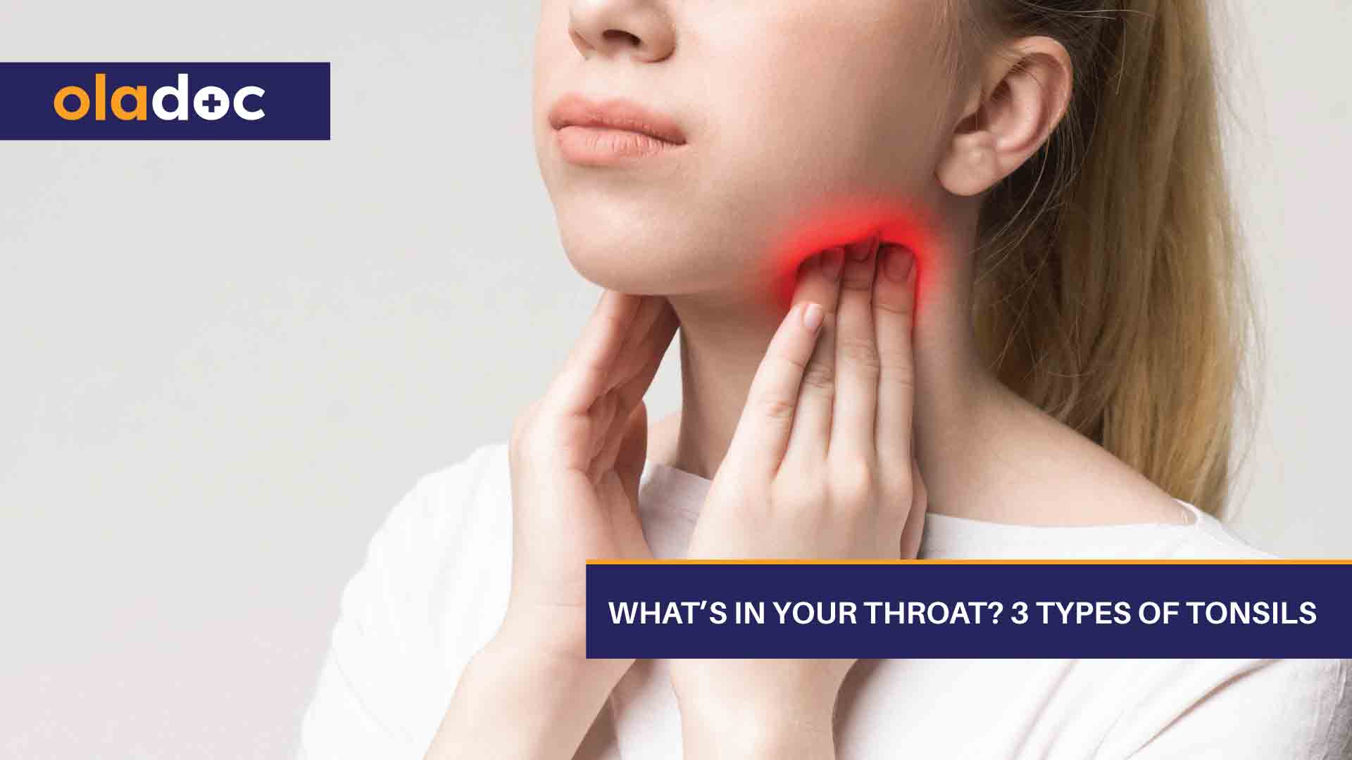 What’s In Your Throat? 3 Types Of Tonsils thumbnail
