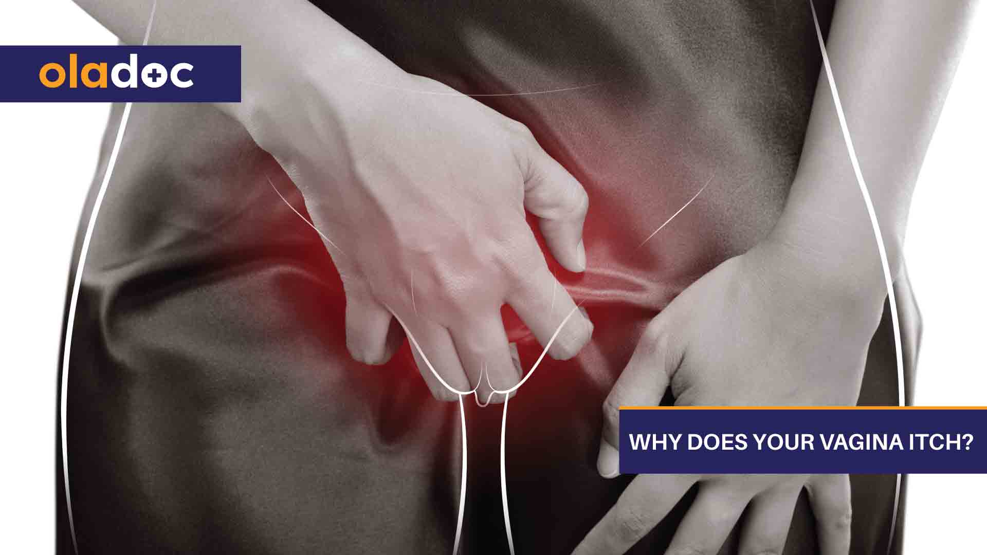 Why Does Your Vagina Itch?