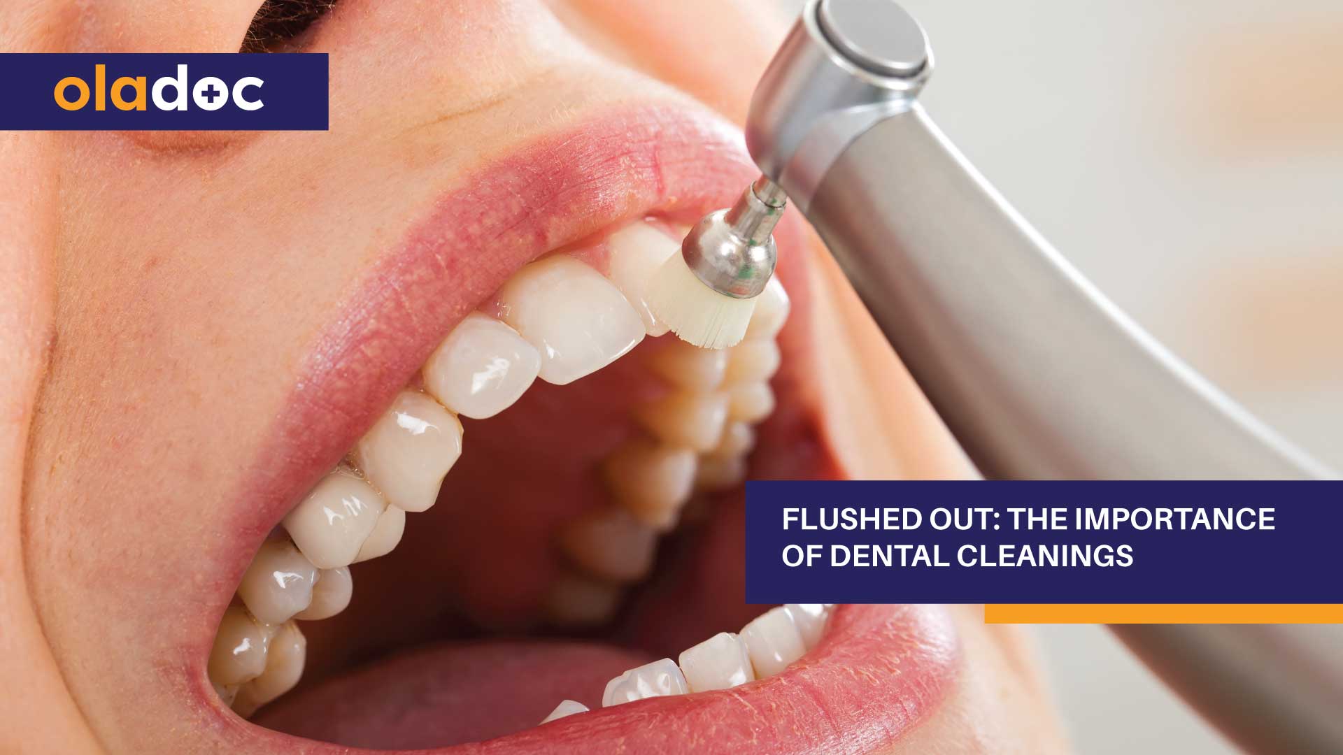 Flushed Out: The Importance Of Dental Cleanings thumbnail