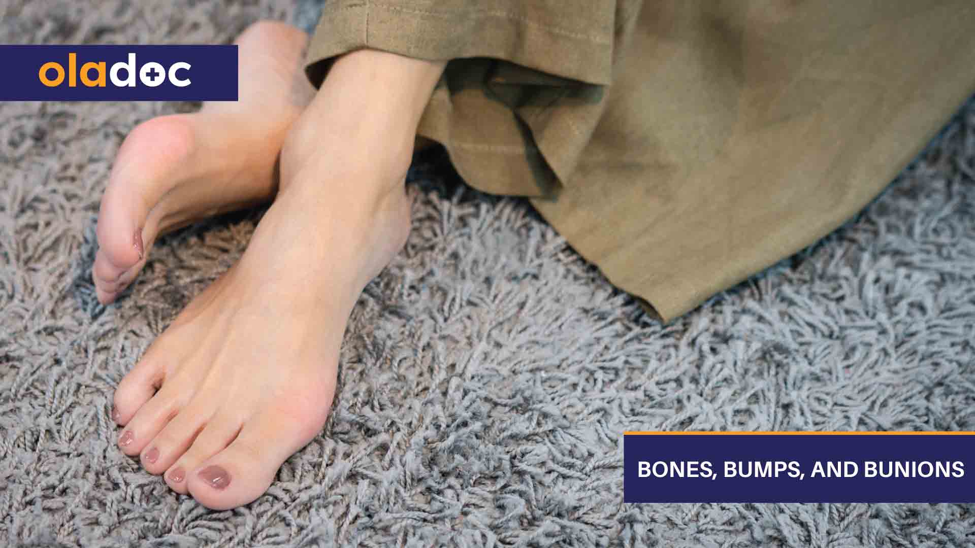 Bones, Bumps, and Bunions thumbnail
