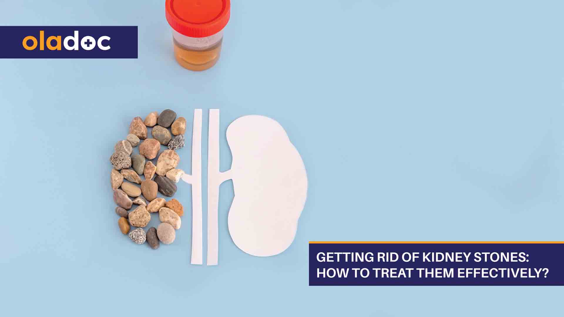 Getting Rid Of Kidney Stones: How To Treat Them Effectively? thumbnail