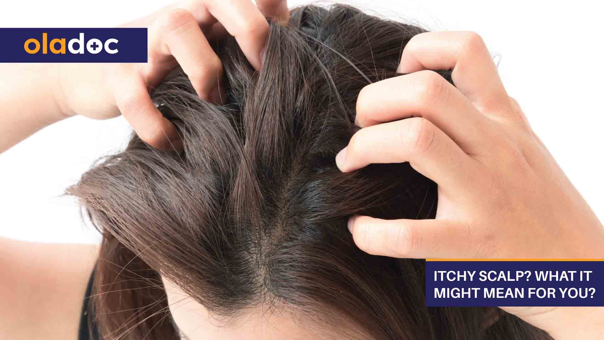 Itchy Scalp? What It Might Mean For You? thumbnail