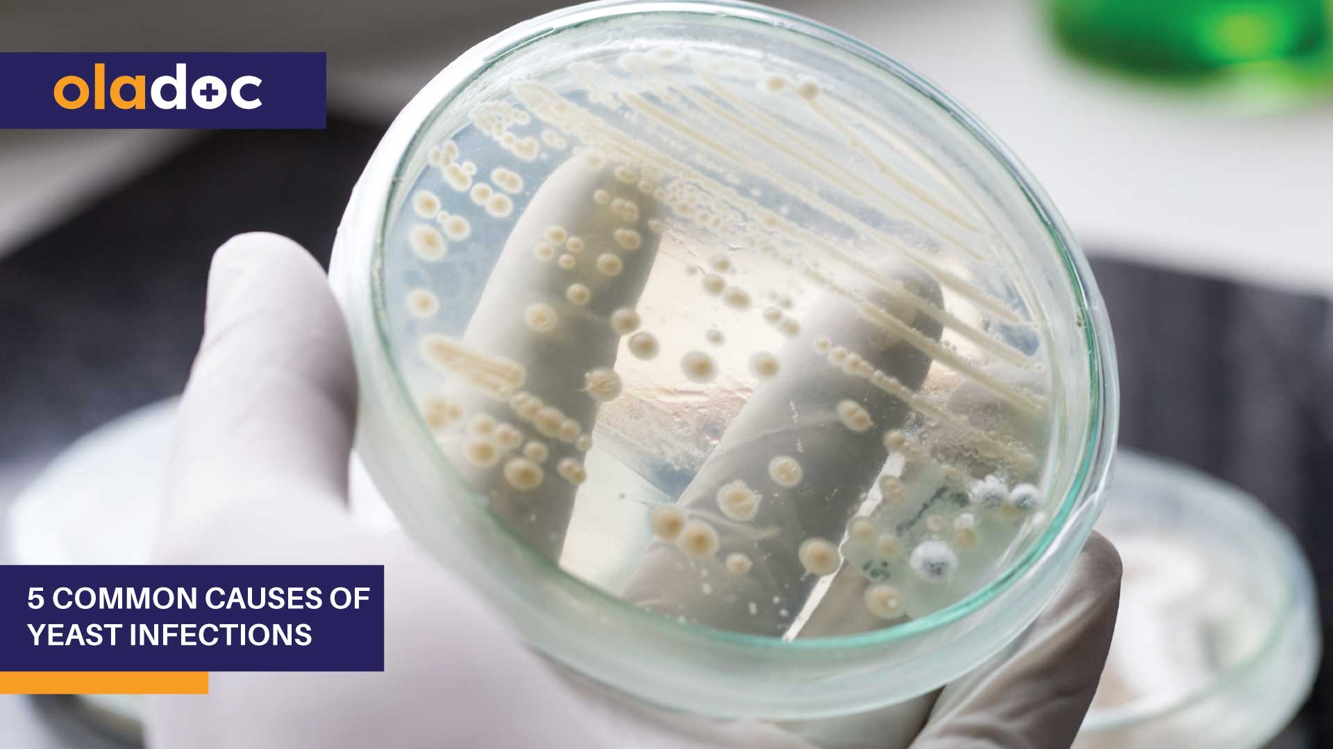 5 Common Causes of Yeast Infections