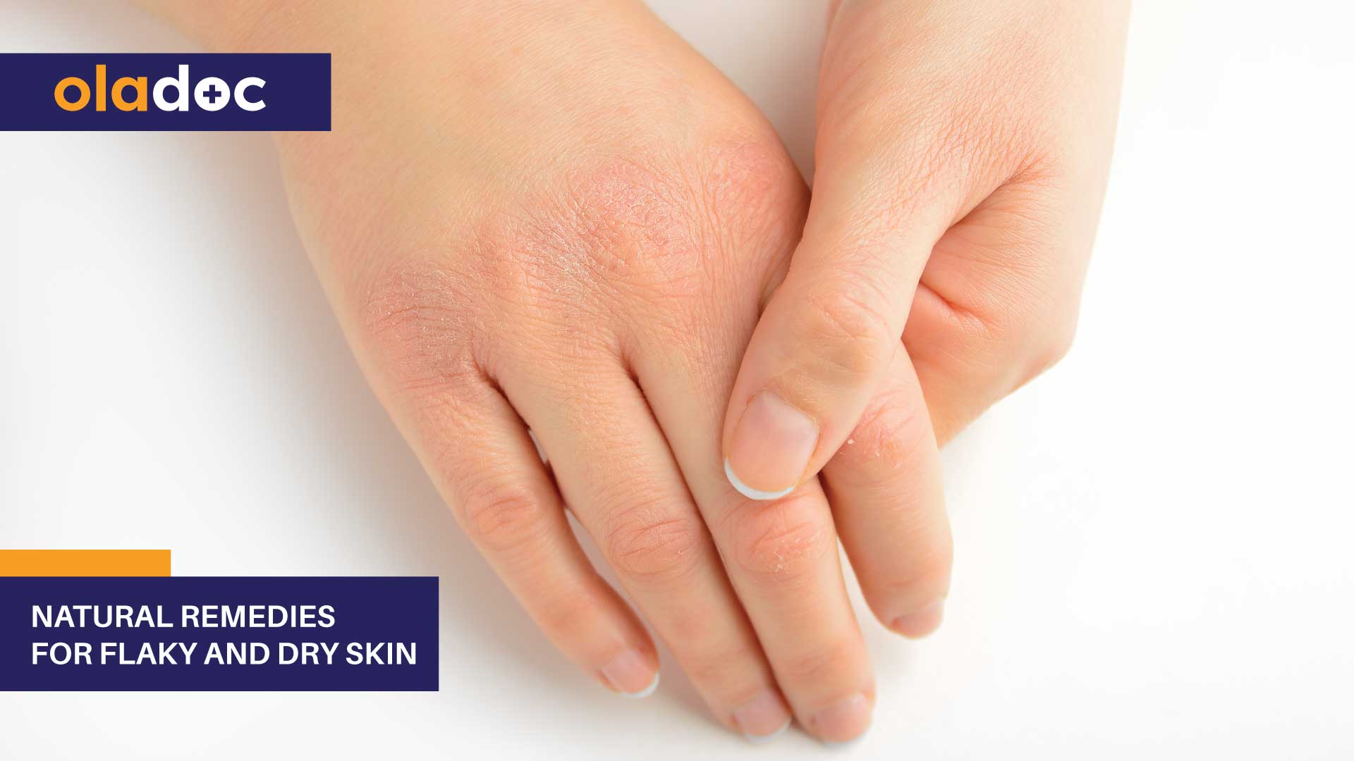 Natural Remedies for Flaky and Dry Skin thumbnail