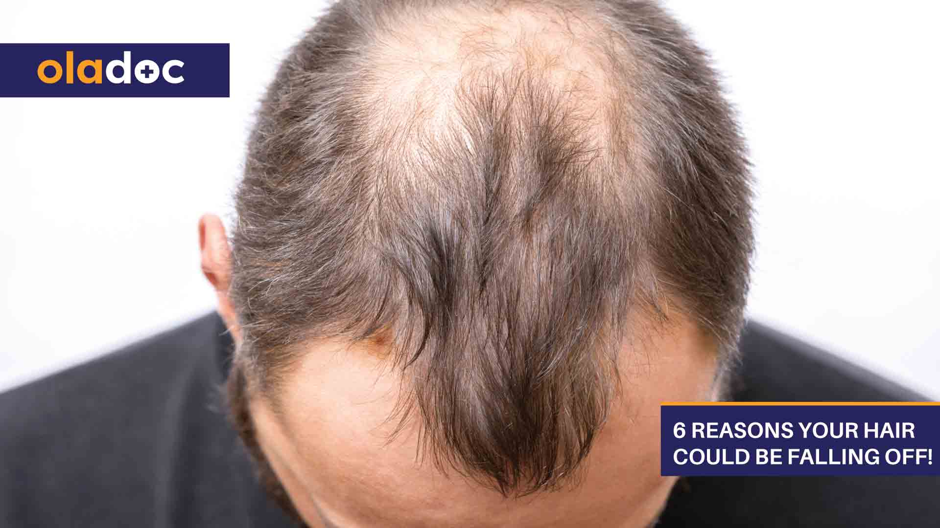 6 Reasons Your Hair Could Be Falling Off! thumbnail