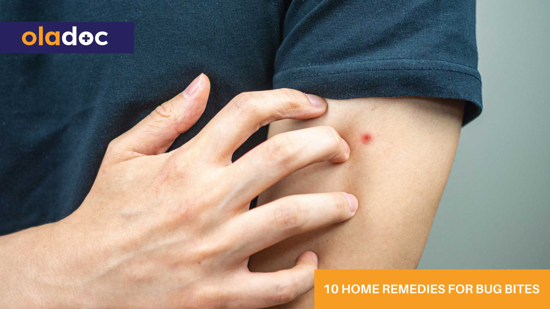 10 Home Remedies for Bug Bites thumbnail