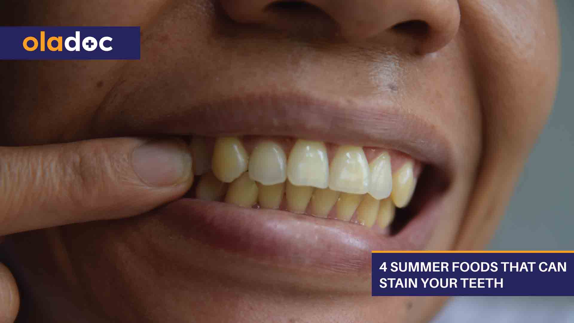 4 Summer Foods That Can Stain Your Teeth thumbnail