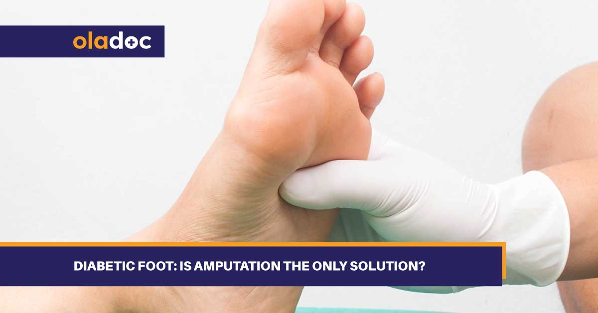 Diabetic Foot: Is Amputation The Only Solution? thumbnail