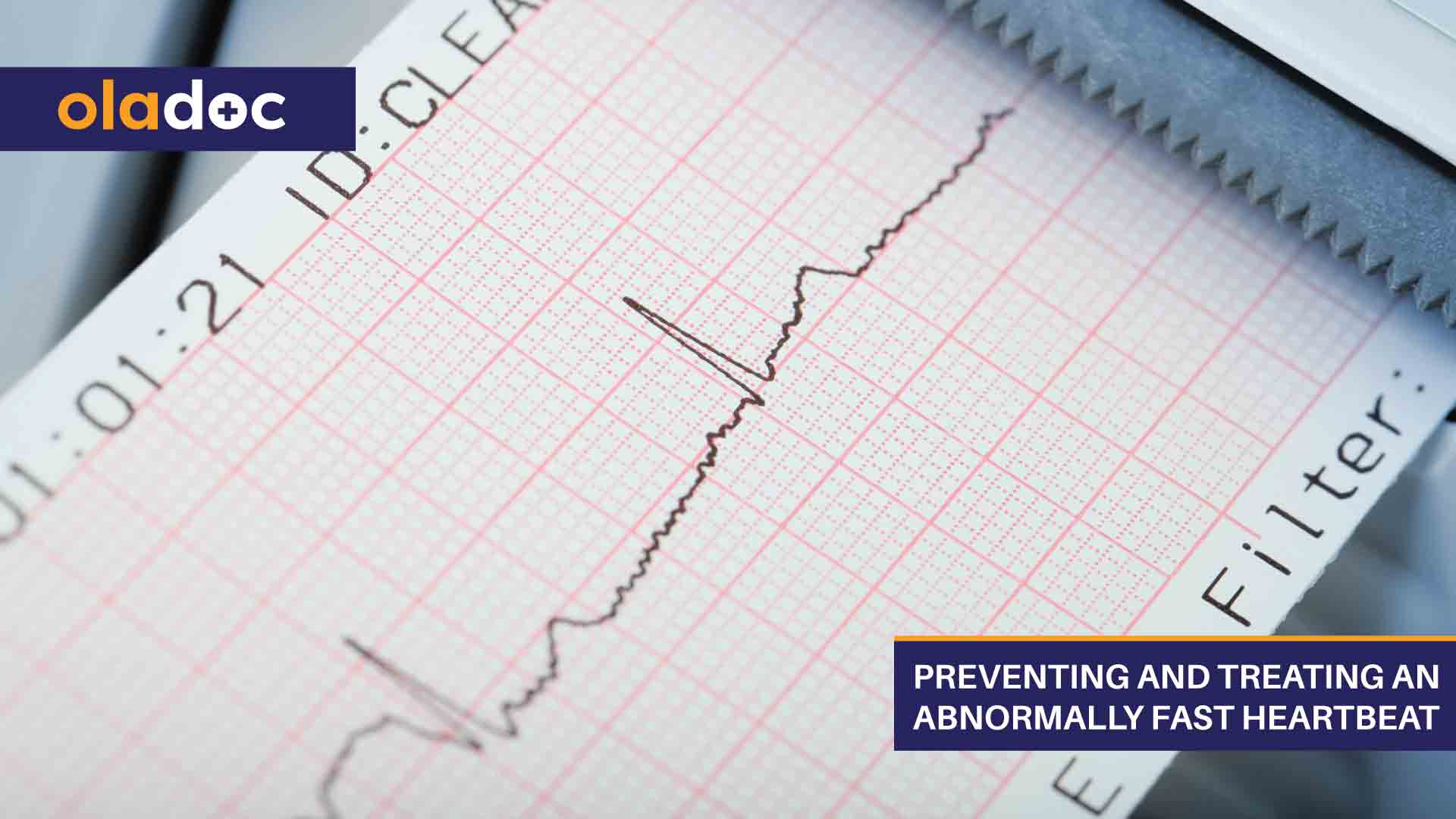 Preventing and Treating an Abnormally Fast Heartbeat thumbnail