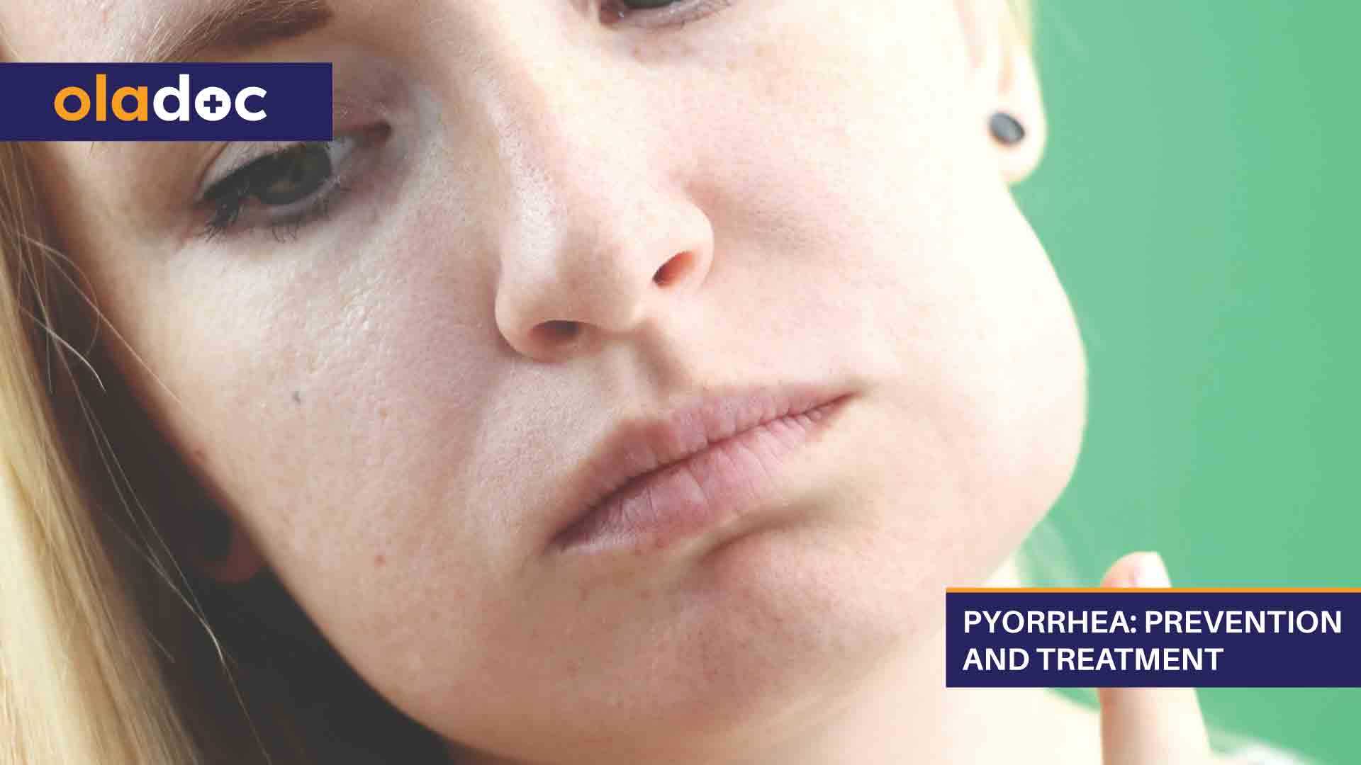 Pyorrhea: Prevention and Treatment thumbnail