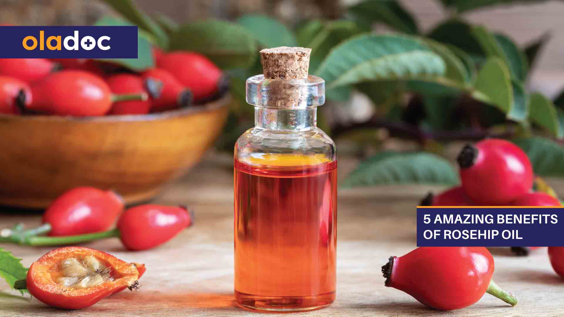 5 Amazing Benefits of Rosehip Oil thumbnail