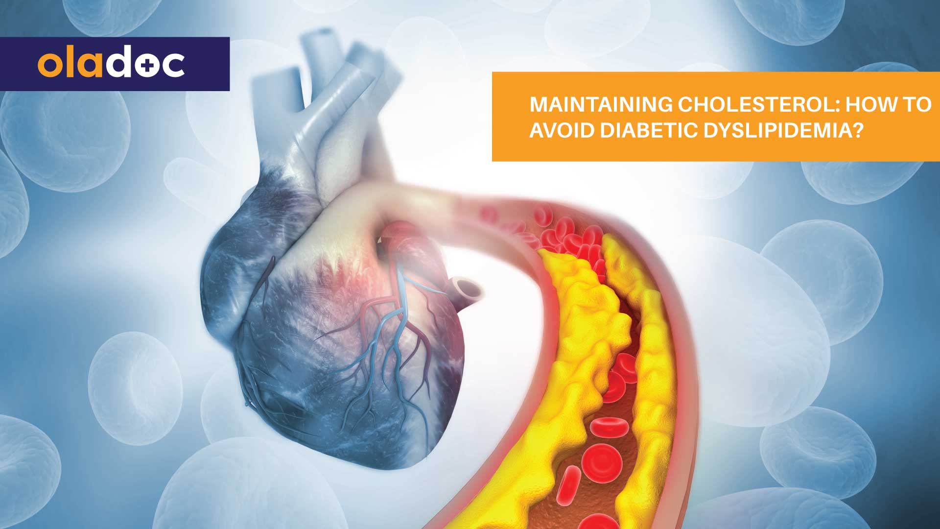 Maintaining Cholesterol: How to Avoid Diabetic Dyslipidemia?