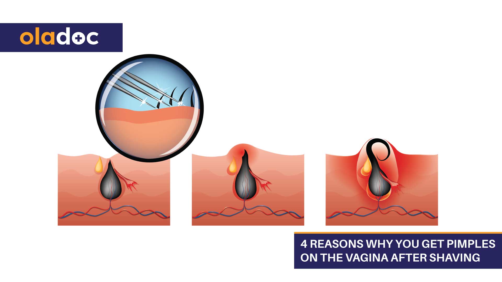 How To Shave Your Virginia