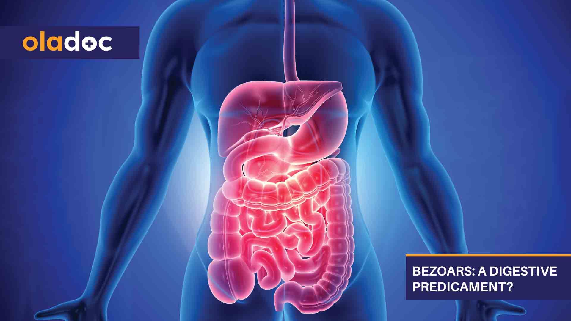 Bezoars: A Digestive Predicament? thumbnail