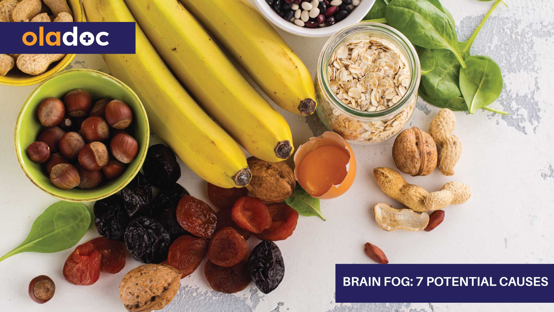 Brain Fog: 7 Potential Causes thumbnail