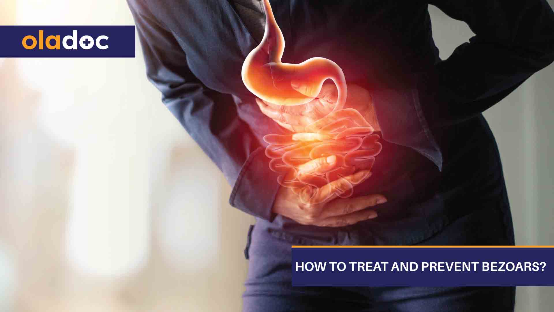 How to Treat and Prevent Bezoars? thumbnail