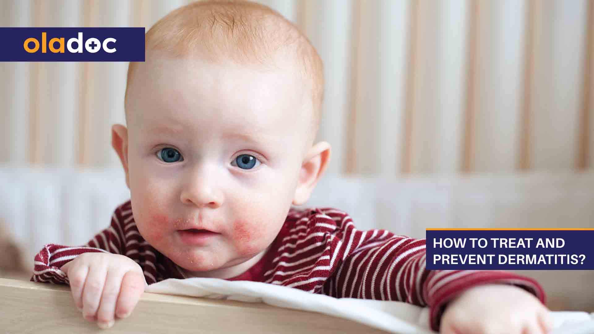 How to Treat and Prevent Dermatitis? thumbnail