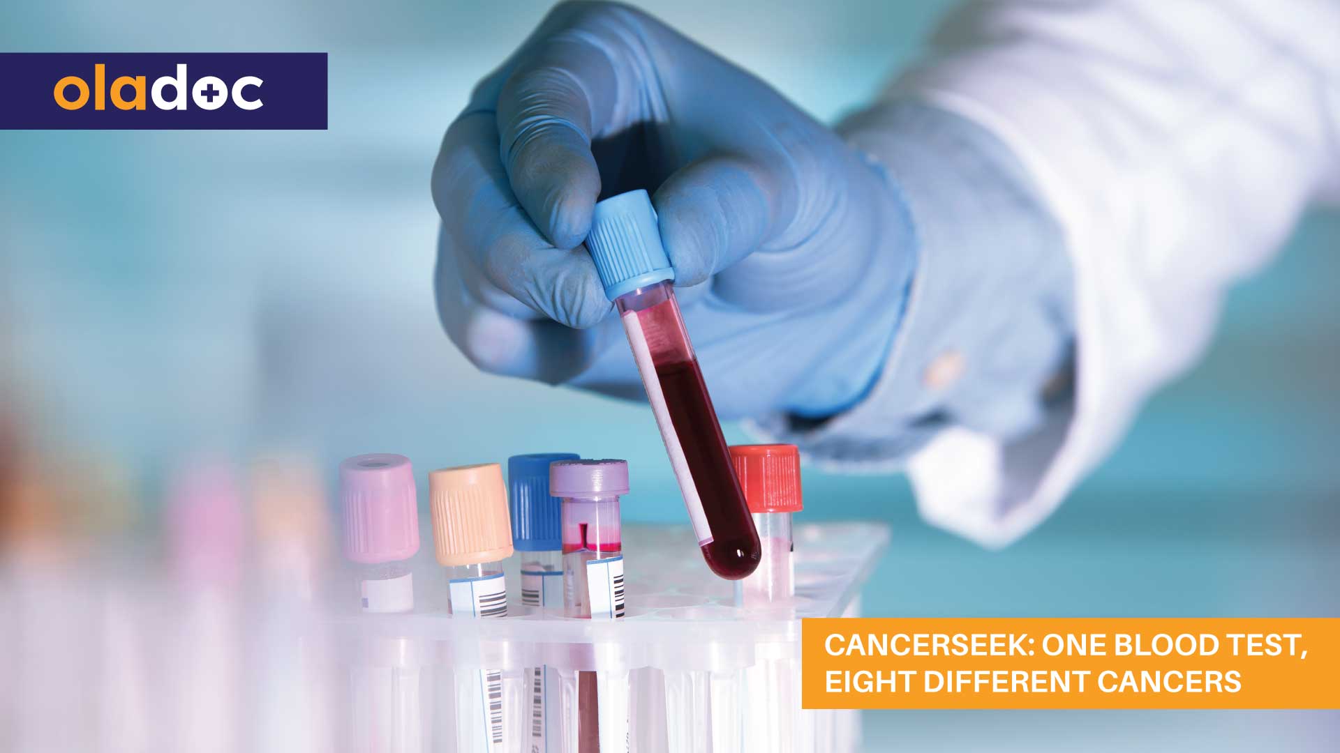 Cancerseek: One Blood Test, Eight Different Cancers thumbnail