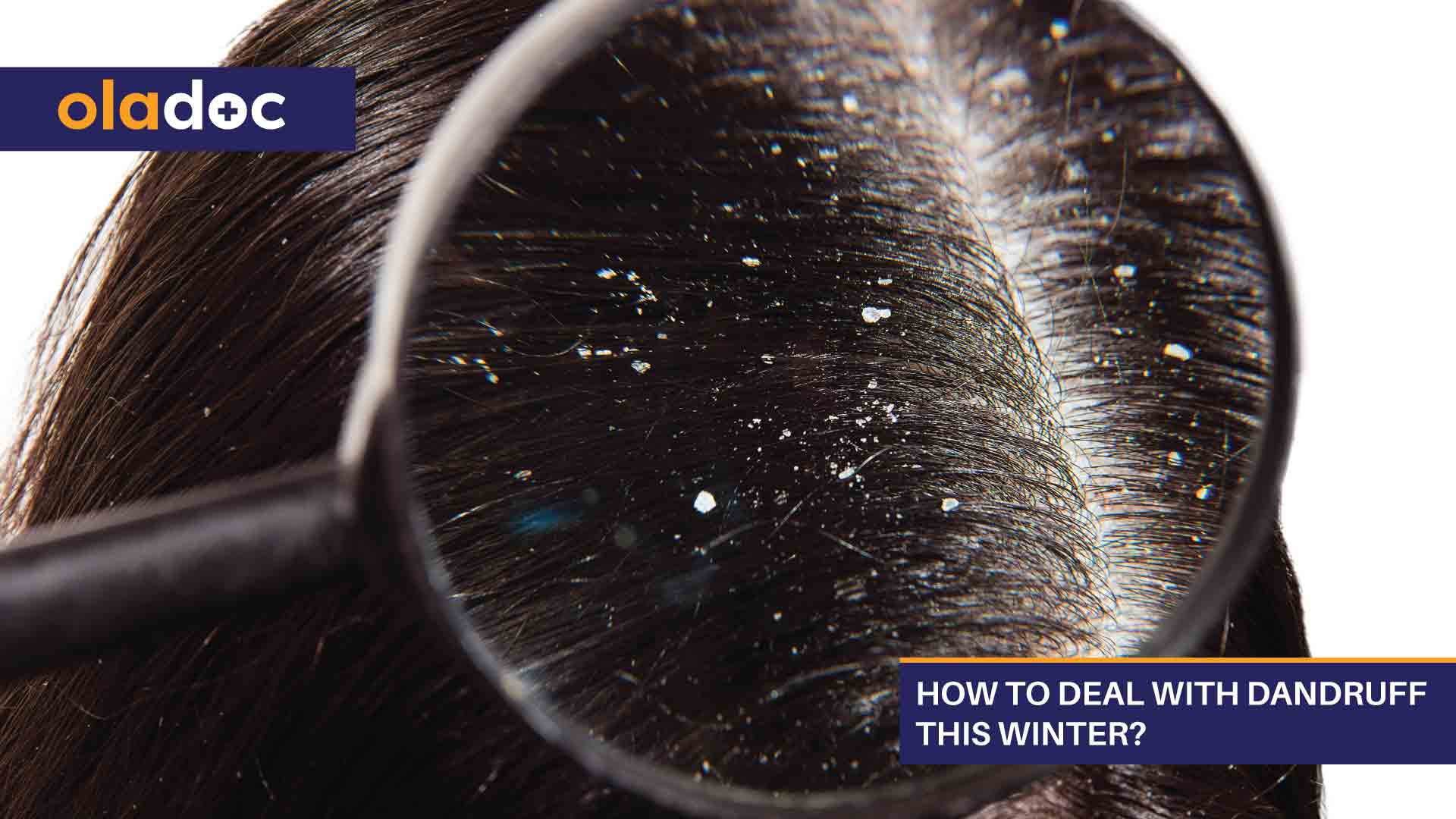 How to Deal With Dandruff This Winter? thumbnail