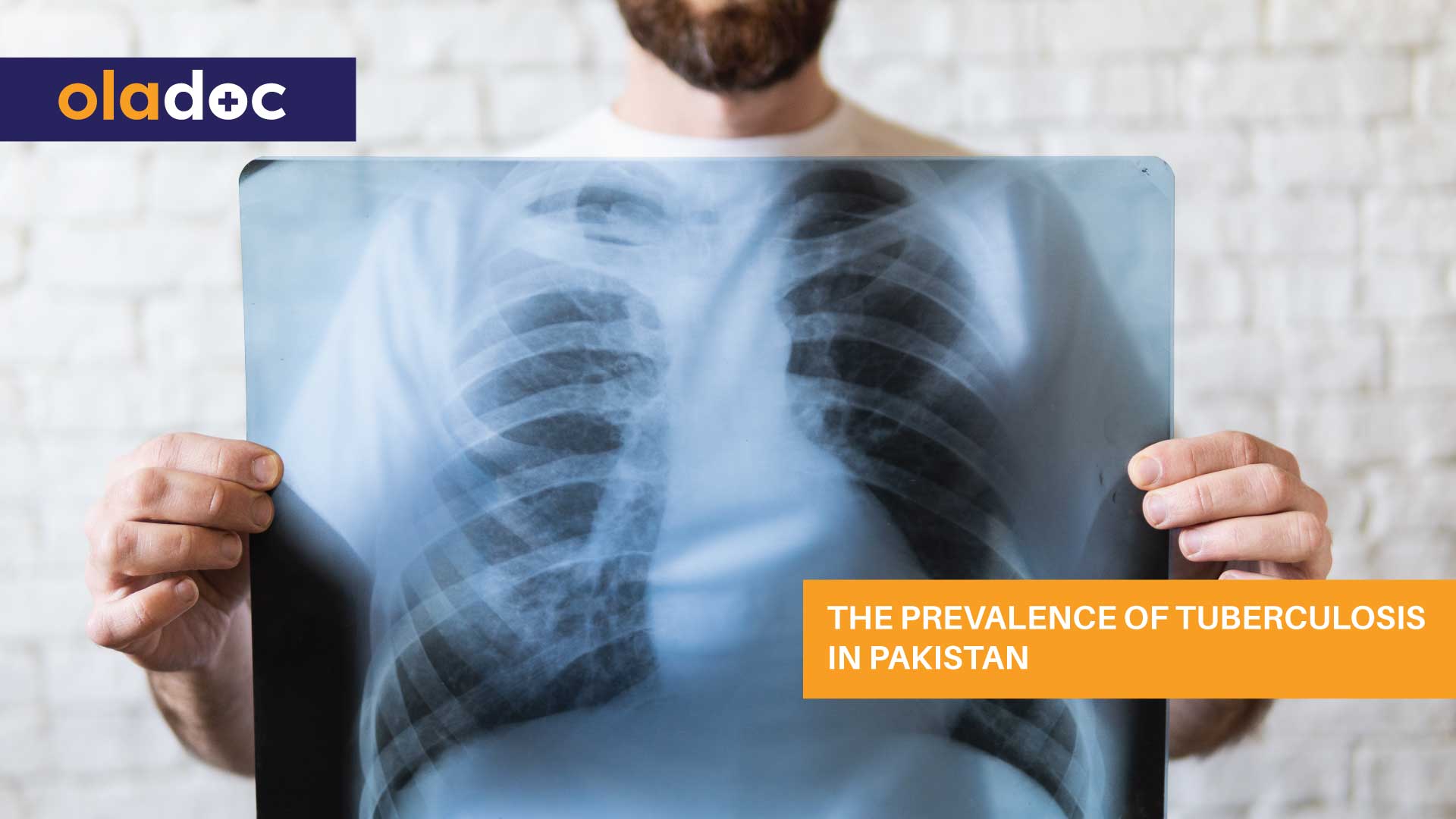 The Prevalence of Tuberculosis in Pakistan thumbnail