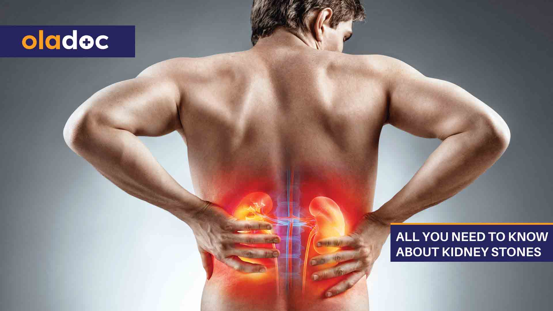 All You Need To Know About Kidney Stones thumbnail