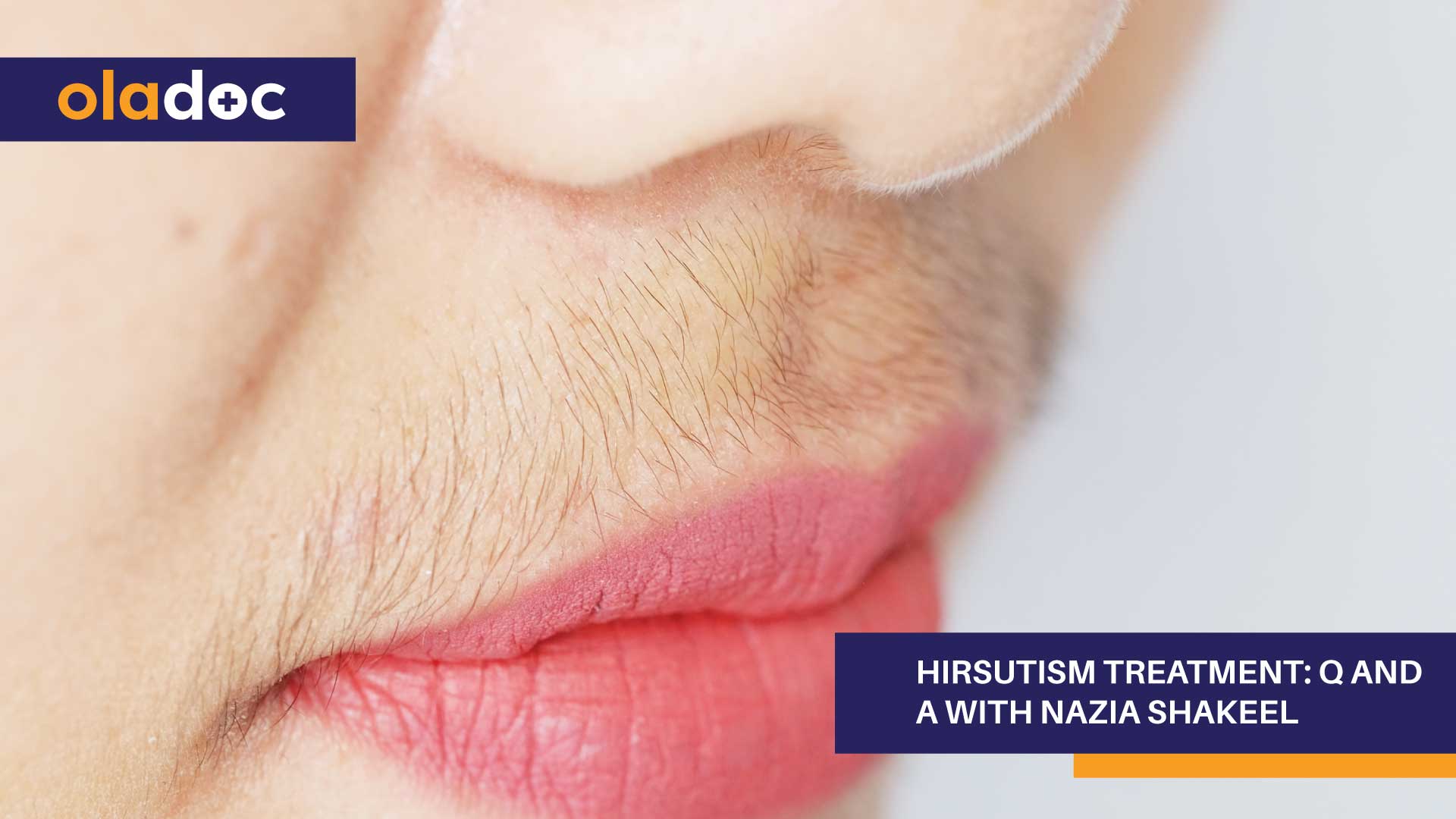 Hirsutism Treatment: Q And A With Nazia Shakeel thumbnail