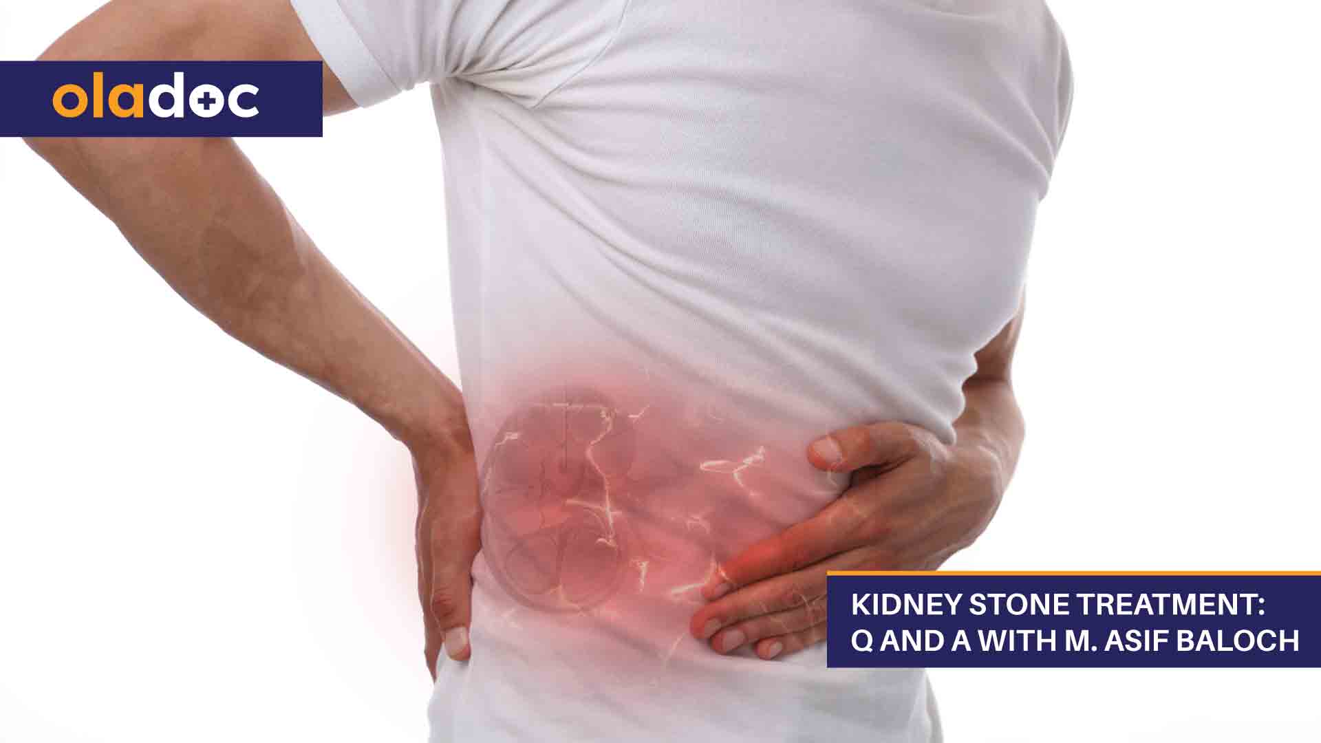 Kidney Stone Treatment: Q And A With M. Asif Baloch thumbnail