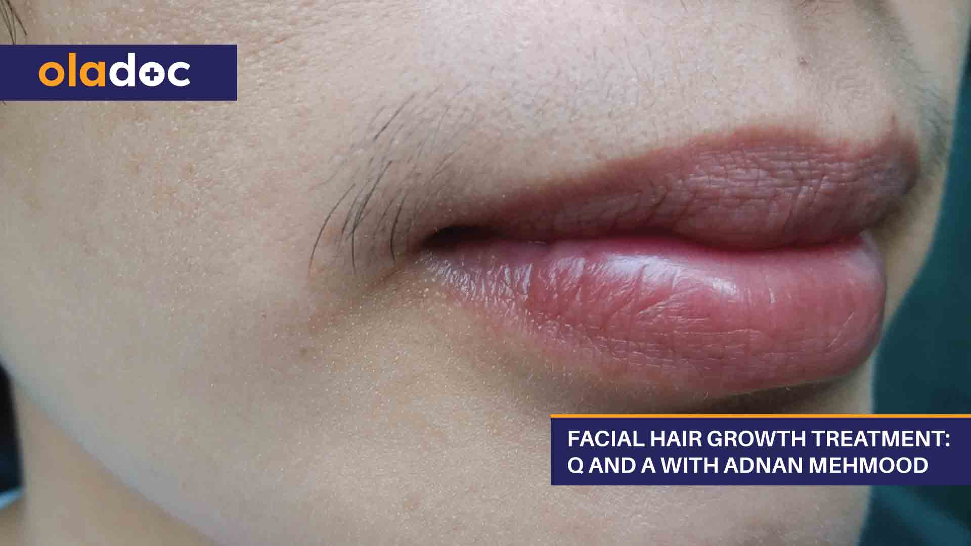 Facial Hair Growth Treatment: Q And A With Adnan Mehmood thumbnail