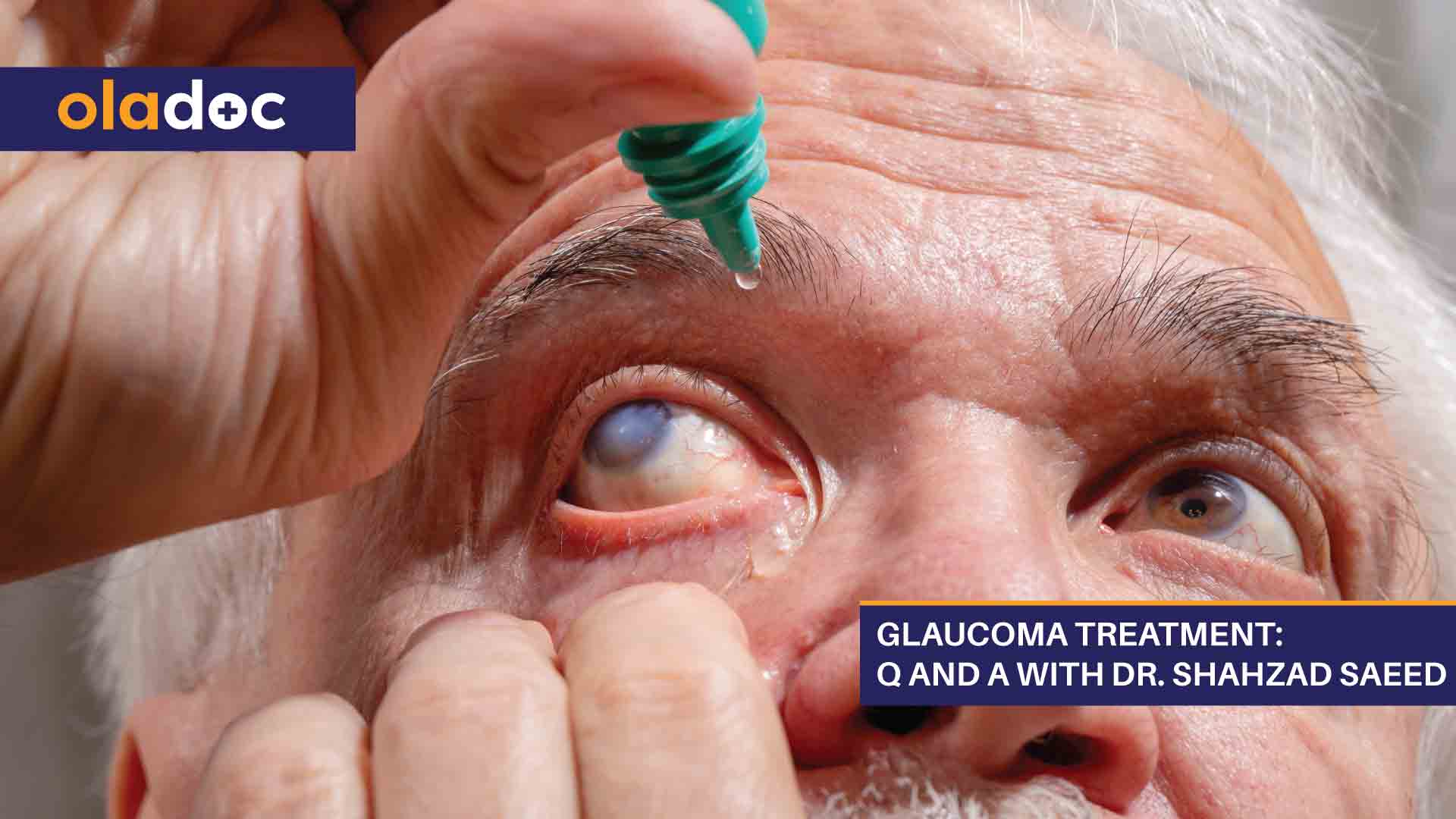 Glaucoma Treatment: Q & A With Dr. Shahzad Saeed thumbnail