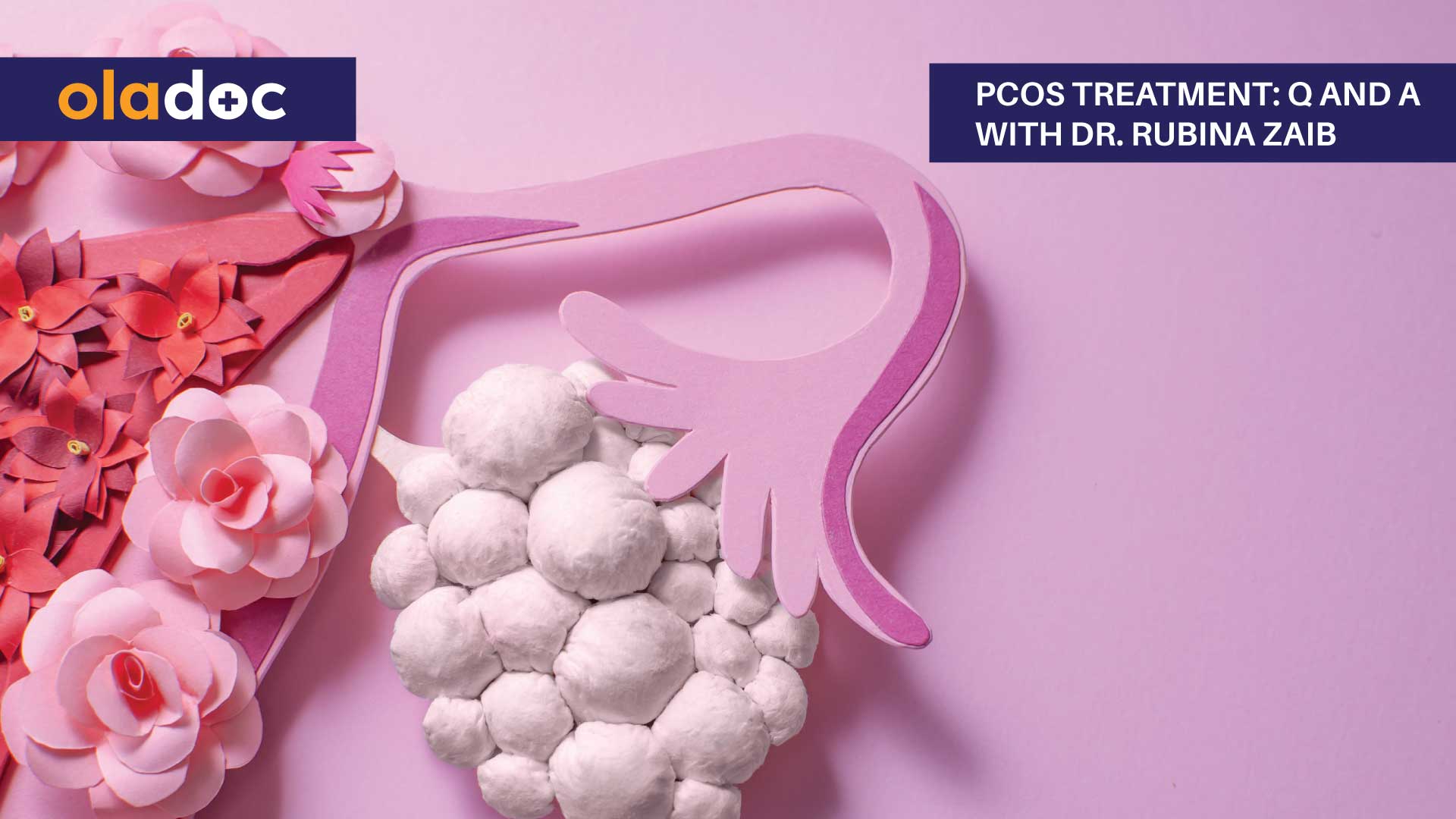 Pcos Treatment: Q And A With Dr. Rubina Zaib thumbnail