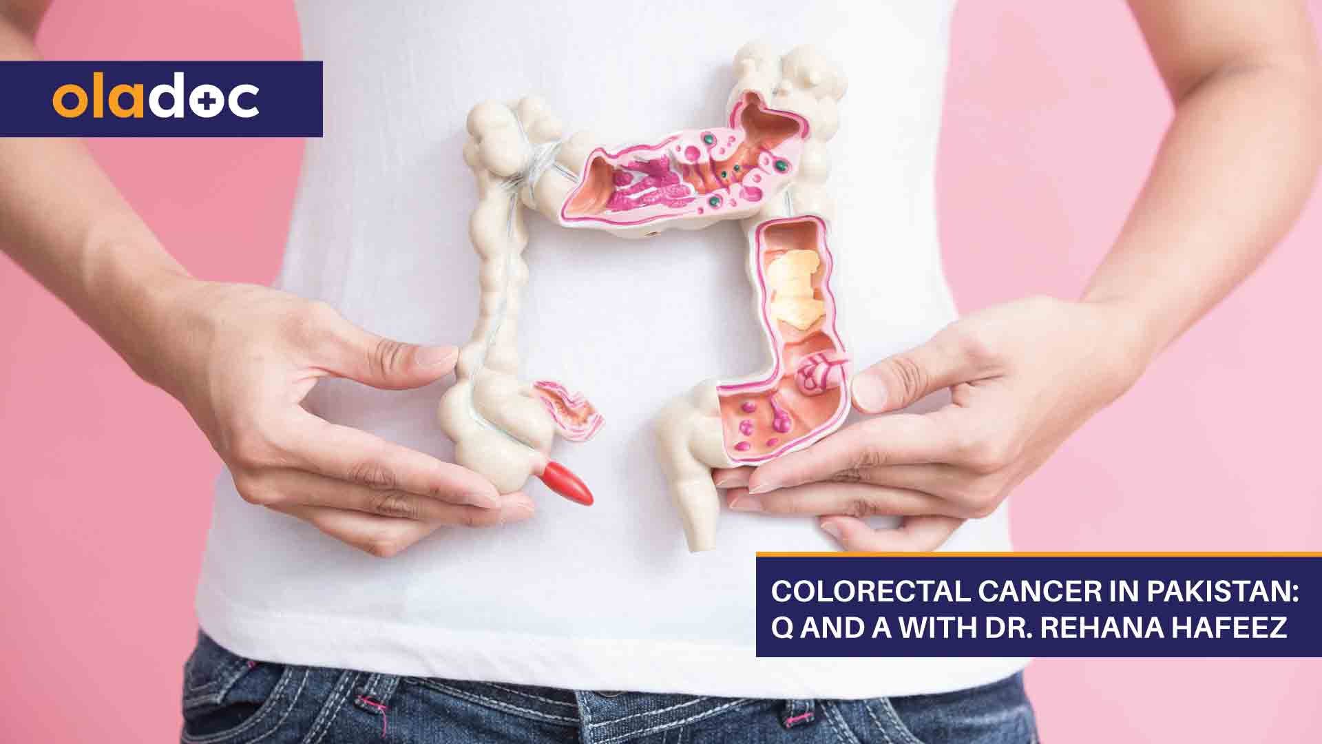 Colorectal Cancer In Pakistan: Q And A With Dr. Rehana Hafeez thumbnail