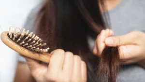 Hairfall
