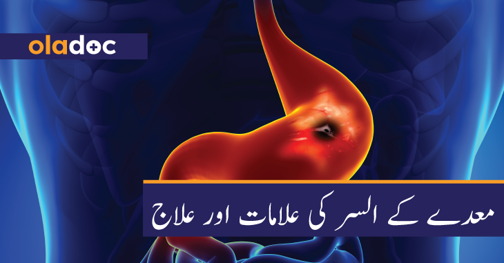 معدے کے السر کی علامات اور علاج thumbnail