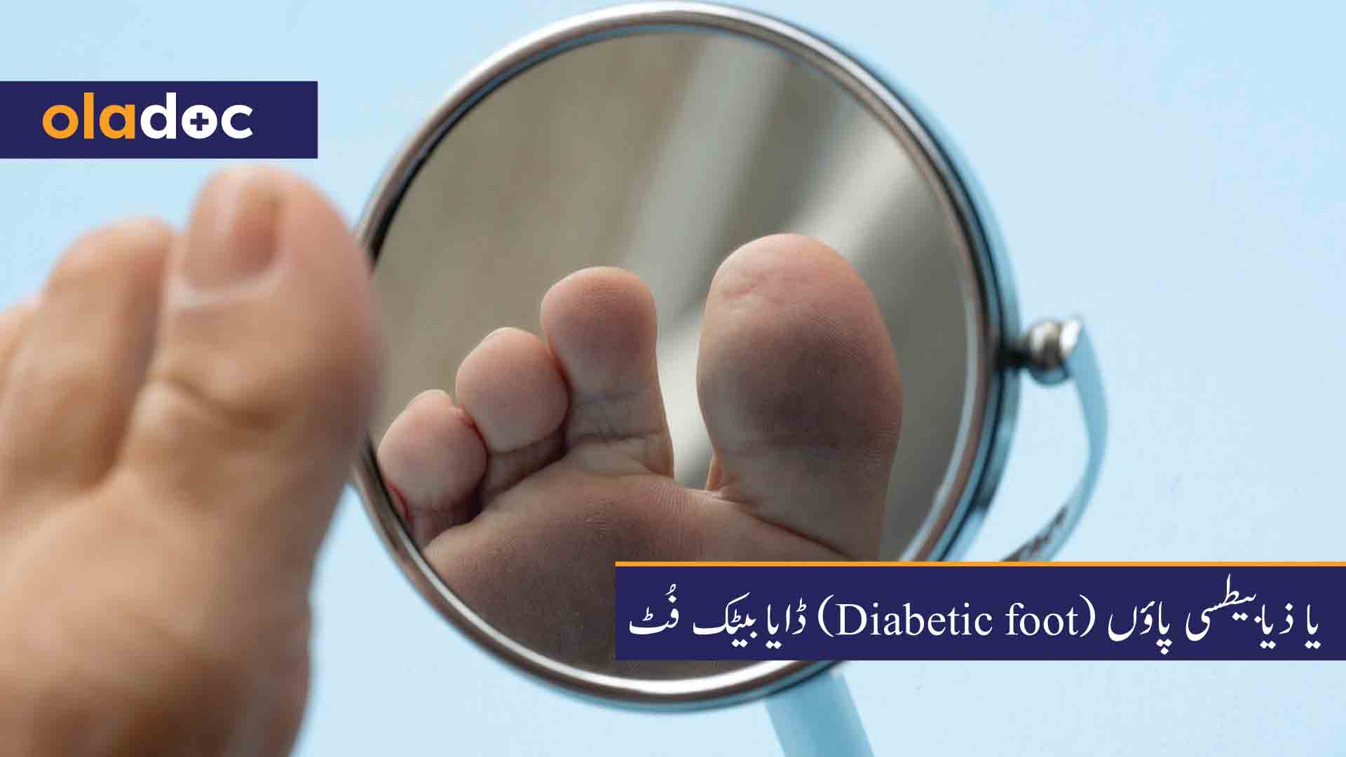 ڈایابیٹک-فُٹ-(Diabetic-foot)-یا-ذیابیطسی-پاؤں