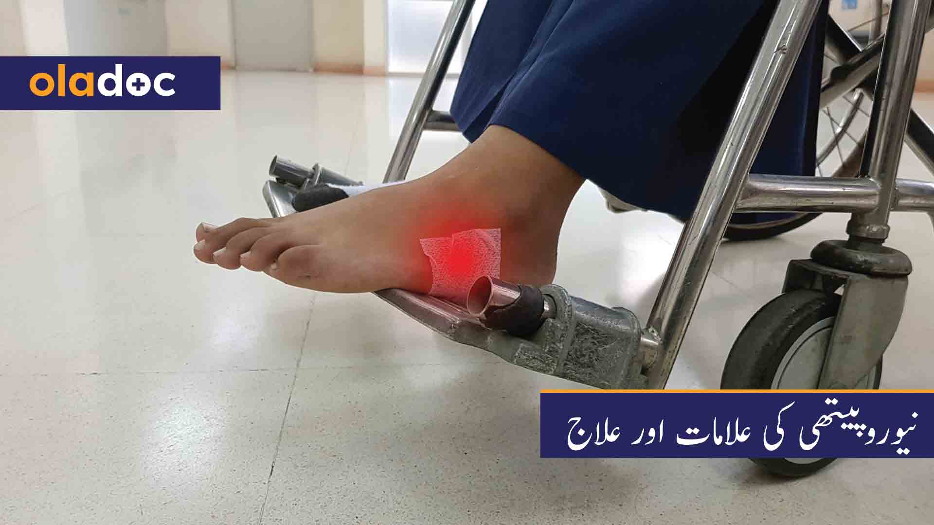 نیوروپیتھی کی علامات اور علاج