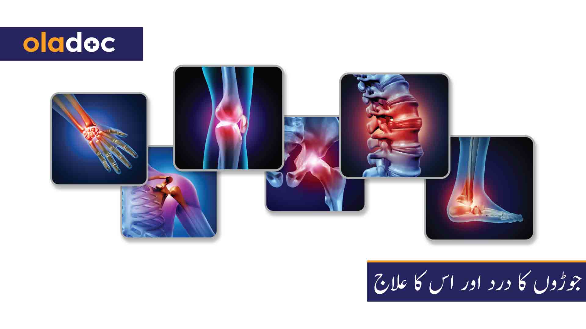 جوڑوں کا درد اور اس کا علاج