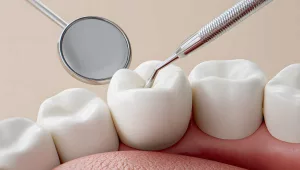 daanton me keeda lagne ki wajoohat aur ilaj