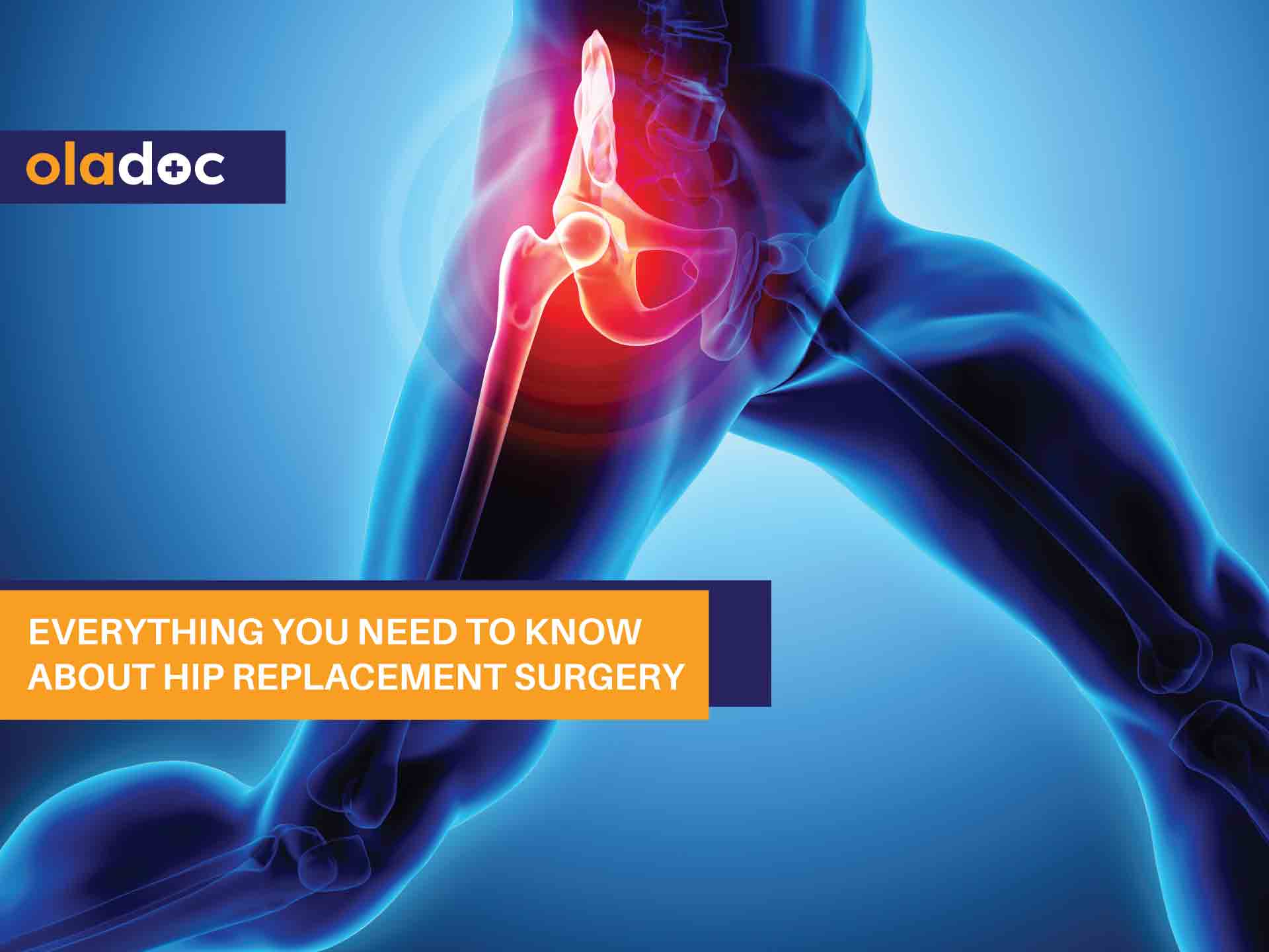 Everything You Need to Know About Hip Replacement Surgery
