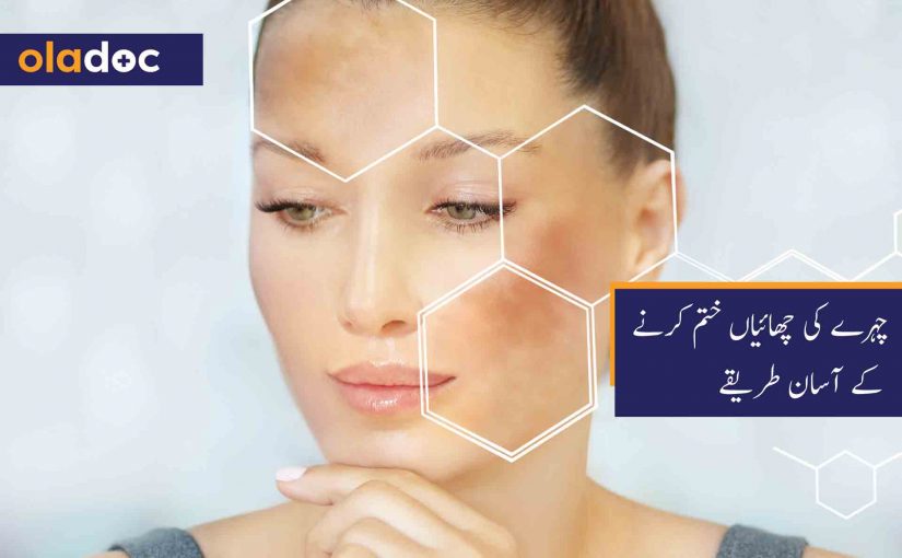 چہرے کی چھائیاں ختم کرنے کے آسان طریقے thumbnail