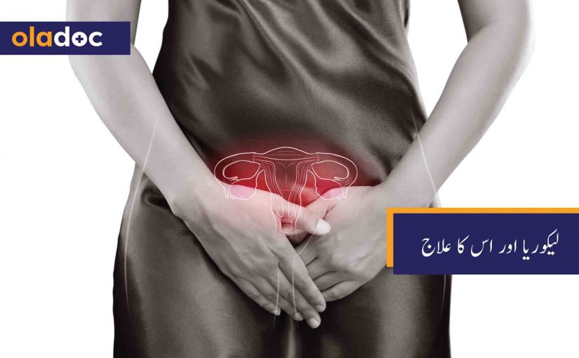 لیکوریا اور اس کا علاج thumbnail