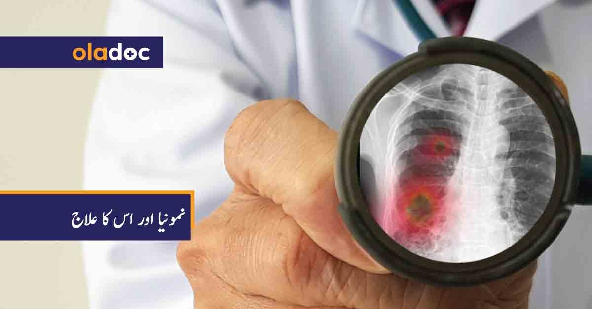 نمونیا اور اس کا علاج thumbnail