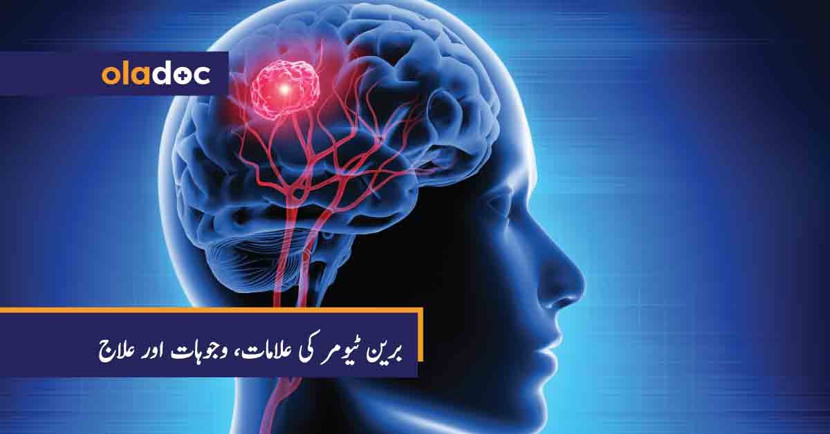 brain tumor