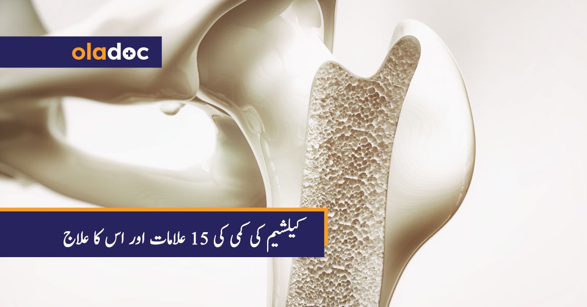 calcium ki kami ki alamat aur ilaj