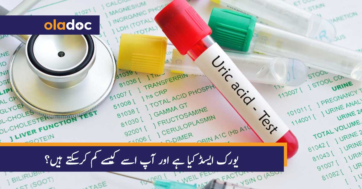 یورک ایسڈ کیا ہے اور آپ اسے کیسے کم کرسکتے ہیں؟ thumbnail