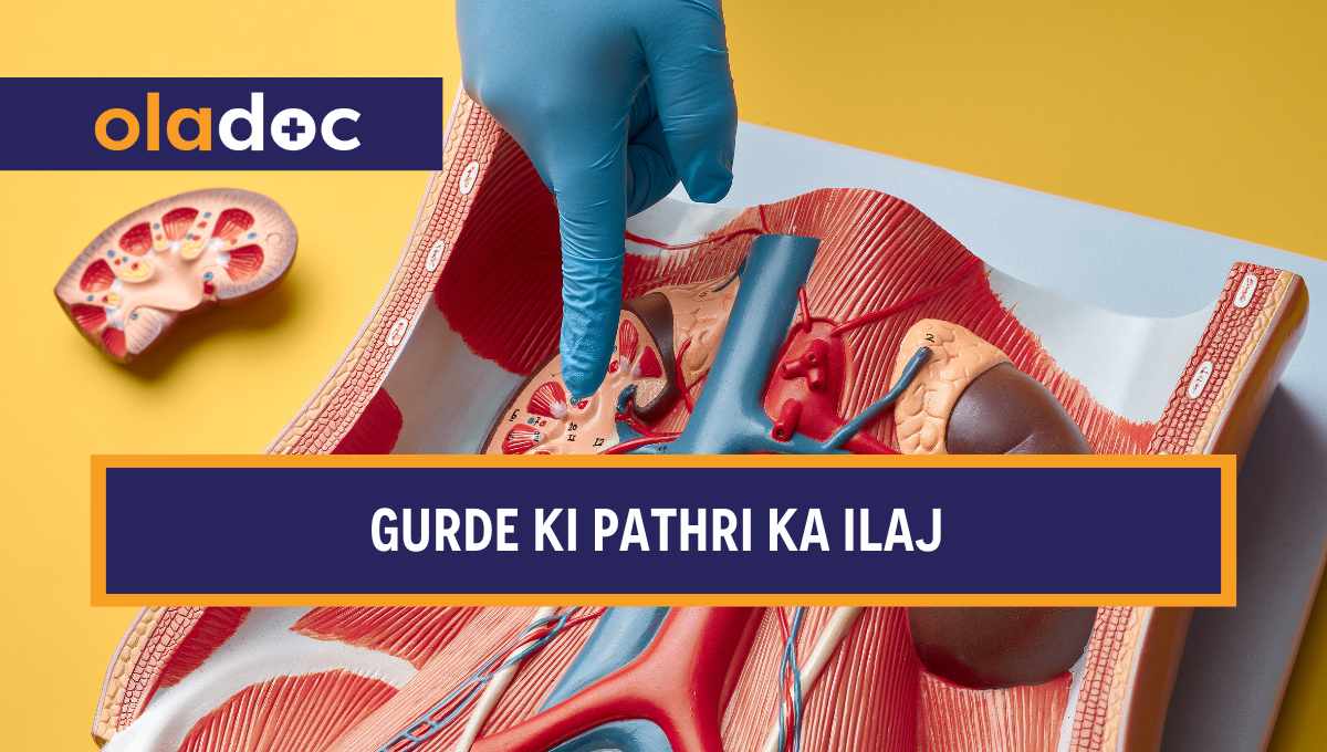 گردے کی پتھری کی وجوہات، علامات اور علاج thumbnail