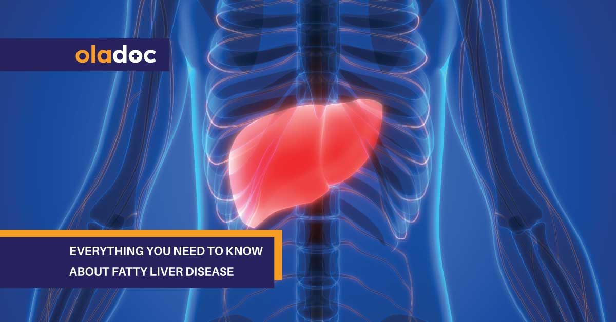 Everything You Need to Know About Fatty Liver Disease thumbnail