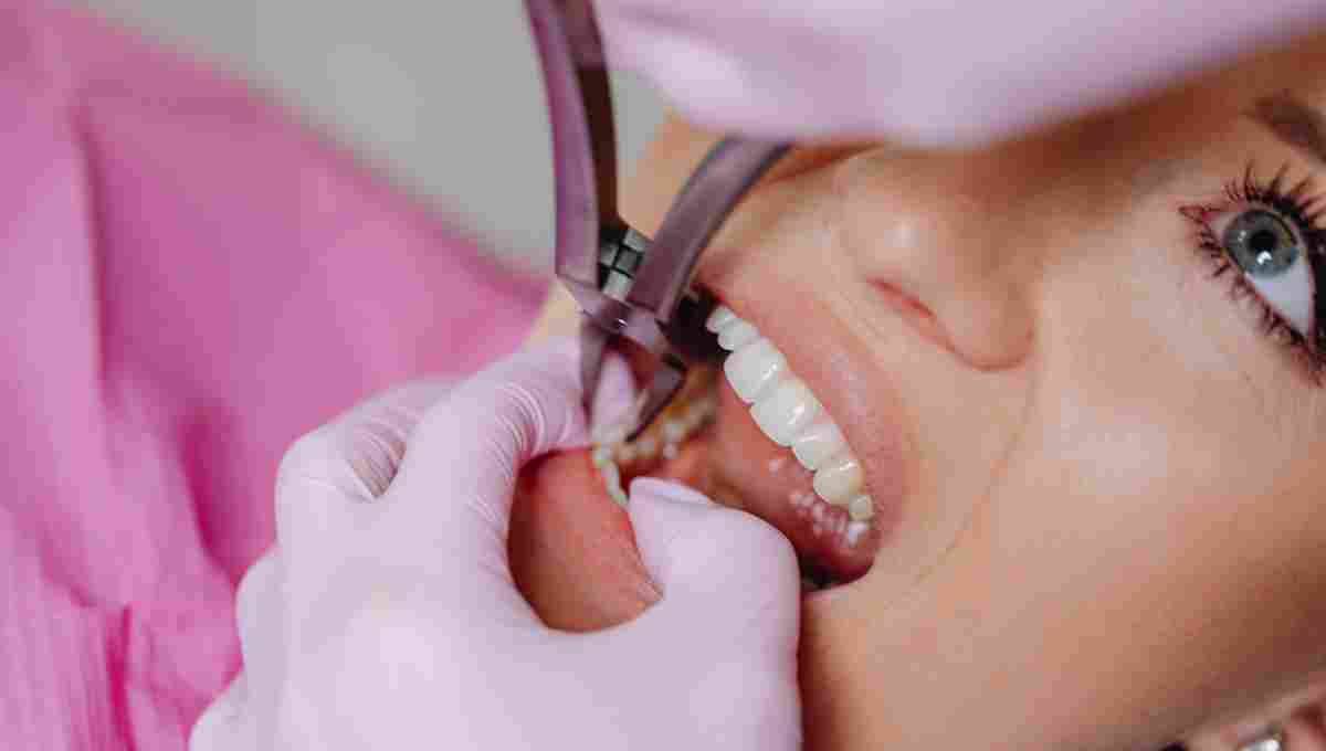 Tooth Impaction and Extraction: A Comprehensive Guide thumbnail