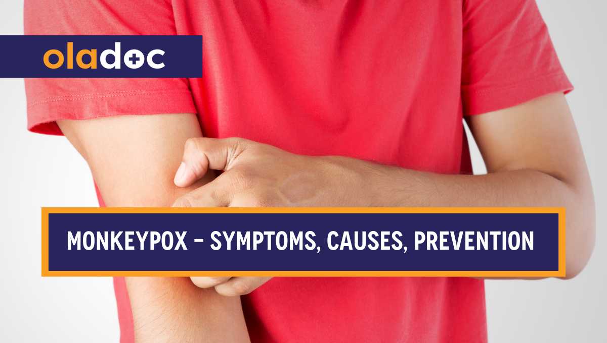 Monkeypox - Symptoms, Causes & Prevention thumbnail