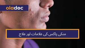 Monkeypox