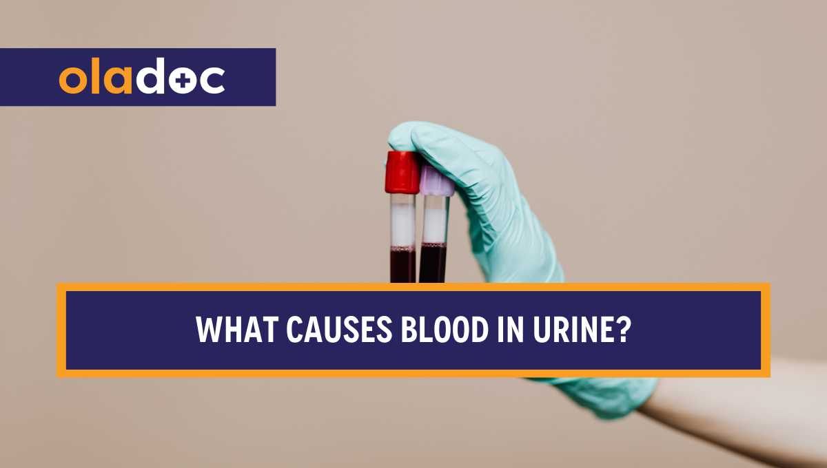 What Causes Blood In Urine And How Can It Be Treated? thumbnail